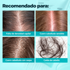 Lunua™ Sérum Capilar PDRN