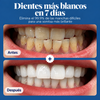 Lunua™ Polvo Blanqueador de Dientes